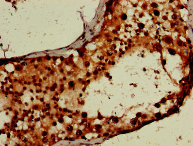 IHC image of RUVBL2 Antibody diluted at 1:600 and staining in paraffin-embedded human testis tissue performed on a Leica BondTM system. After dewaxing and hydration, antigen retrieval was mediated by high pressure in a citrate buffer (pH 6.0). Section was blocked with 10% normal goat serum 30min at RT. Then primary antibody (1% BSA) was incubated at 4°C overnight. The primary is detected by a biotinylated secondary antibody and visualized using an HRP conjugated SP system.Rabbit anti-Human RUVBL2 Polyclonal Antibody