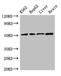 Western Blot | Positive WB detected in: K562 whole cell lysate, HepG2 whole cell lysate, Rat liver tissue, Mouse brain tissue | All lanes: RUVBL2 antibody at 2.4μg/ml | Secondary | Goat polyclonal to rabbit IgG at 1/50000 dilution | Predicted band size: 52, 47 kDa | Observed band size: 52 kDaRabbit anti-Human RUVBL2 Polyclonal Antibody