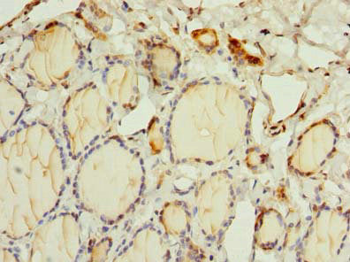Immunohistochemistry of paraffin-embedded human thyroid tissue using OSGIN2 Antibody at dilution of 1:100Rabbit anti-Human OSGIN2 Polyclonal Antibody
