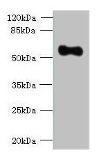 Western blot | All lanes: OSGIN2 antibody at 0.8μg/ml + HepG2 whole cell lysate | Secondary | Goat polyclonal to rabbit IgG at 1/10000 dilution | Predicted band size: 57, 62 kDa | Observed band size: 57 kDaRabbit anti-Human OSGIN2 Polyclonal Antibody