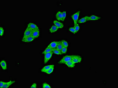 Immunofluorescent analysis of HepG2 cells using BTRC Antibody at dilution of 1:100 and Alexa Fluor 488-congugated AffiniPure Goat Anti-Rabbit IgG(H+L)