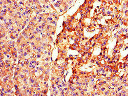 Immunohistochemistry of paraffin-embedded human pancreatic tissue using BTRC Antibody at dilution of 1:100
