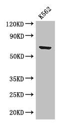 Western Blot  | Positive WB detected in: K562 whole cell lysate  | All lanes: BTRC antibody at 2.8µg/ml  | Secondary  | Goat polyclonal to rabbit IgG at 1/50000 dilution  | Predicted band size: 69, 66 kDa  | Observed band size: 69 kDa
