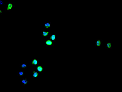 Immunofluorescence staining of Hela cell with ICE1 Antibody at 1:200, counter-stained with DAPI. The cells were fixed in 4% formaldehyde and blocked in 10% normal Goat Serum. The cells were then incubated with the antibody overnight at 4C. The secondary antibody was Alexa Fluor 488-congugated AffiniPure Goat Anti-Rabbit IgG(H+L).Rabbit anti-Human ICE1 Polyclonal Antibody