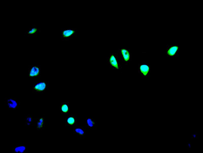 Immunofluorescence staining of A549 cell with ICE1 Antibody at 1:200, counter-stained with DAPI. The cells were fixed in 4% formaldehyde and blocked in 10% normal Goat Serum. The cells were then incubated with the antibody overnight at 4C. The secondary antibody was Alexa Fluor 488-congugated AffiniPure Goat Anti-Rabbit IgG(H+L).Rabbit anti-Human ICE1 Polyclonal Antibody