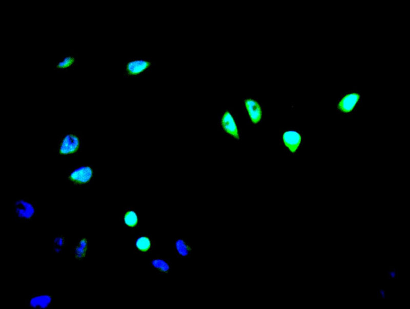 Immunofluorescence staining of A549 cell with ICE1 Antibody at 1:200, counter-stained with DAPI. The cells were fixed in 4% formaldehyde and blocked in 10% normal Goat Serum. The cells were then incubated with the antibody overnight at 4C. The secondary antibody was Alexa Fluor 488-congugated AffiniPure Goat Anti-Rabbit IgG(H+L).Rabbit anti-Human ICE1 Polyclonal Antibody