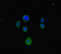 Immunofluorescent analysis of MCF-7 cells using LRCH1 Antibody at dilution of 1:100 and Alexa Fluor 488-congugated AffiniPure Goat Anti-Rabbit IgG(H+L)