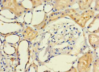 Immunohistochemistry of paraffin-embedded human kidney tissue using LRCH1 Antibody at dilution of 1:100