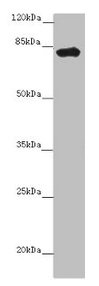 Western blot  | All lanes: LRCH1 antibody at 15µg/ml + Hela whole cell lysate  | Secondary  | Goat polyclonal to rabbit IgG at 1/10000 dilution  | Predicted band size: 81, 78, 85 kDa  | Observed band size: 81 kDa