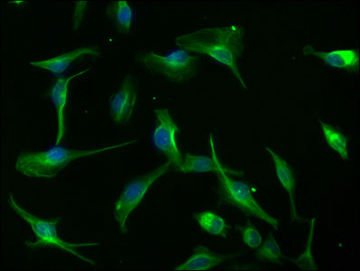 Immunofluorescence staining of U251 cells with AXIN2 Antibody at 1:100, counter-stained with DAPI. The cells were fixed in 4% formaldehyde, permeabilized using 0.2% Triton X-100 and blocked in 10% normal Goat Serum. The cells were then incubated with the antibody overnight at 4°C. The secondary antibody was Alexa Fluor 488-congugated AffiniPure Goat Anti-Rabbit IgG(H+L).