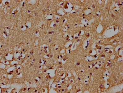 IHC image of AXIN2 Antibody diluted at 1:100 and staining in paraffin-embedded human brain tissue performed on a Leica BondTM system. After dewaxing and hydration, antigen retrieval was mediated by high pressure in a citrate buffer (pH 6.0). Section was blocked with 10% normal goat serum 30min at RT. Then primary antibody (1% BSA) was incubated at 4°C overnight. The primary is detected by a biotinylated secondary antibody and visualized using an HRP conjugated SP system.