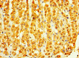 Immunohistochemistry of paraffin-embedded human adrenal gland tissue using DHRS7 Antibody at dilution of 1:100Rabbit anti-Human DHRS7 Polyclonal Antibody