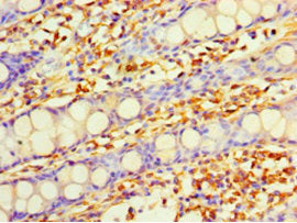 Immunohistochemistry of paraffin-embedded human colon tissue using DHRS7 Antibody at dilution of 1:100Rabbit anti-Human DHRS7 Polyclonal Antibody