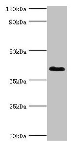 Western blot | All lanes: DHRS7 antibody at 2μg/ml + MCF-7 whole cell lysate | Secondary | Goat polyclonal to rabbit IgG at 1/10000 dilution | Predicted band size: 39, 33 kDa | Observed band size: 39 kDaRabbit anti-Human DHRS7 Polyclonal Antibody