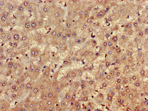 Immunohistochemistry of paraffin-embedded human liver tissue using FARP1 Antibody at dilution of 1:100Rabbit anti-Human FARP1 Polyclonal Antibody