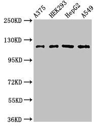 Western Blot | Positive WB detected in: A375 whole cell lysate, HEK293 whole cell lysate, HepG2 whole cell lysate, A549 whole cell lysate | All lanes: FARP1 antibody at 3μg/ml | Secondary | Goat polyclonal to rabbit IgG at 1/50000 dilution | Predicted band size: 119, 123, 15 kDa | Observed band size: 119 kDaRabbit anti-Human FARP1 Polyclonal Antibody