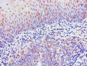 Immunohistochemistry of paraffin-embedded human tonsil tissue using the antibody at dilution of 1:100Rabbit anti-Human RIPK3 Polyclonal Antibody