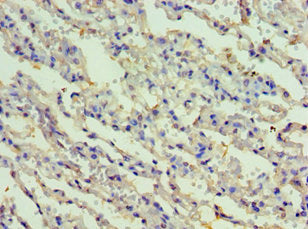 Immunohistochemistry of paraffin-embedded human lung tissue using RIPK3 Antibody at dilution of 1:100Rabbit anti-Human RIPK3 Polyclonal Antibody