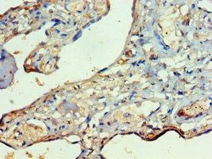 Immunohistochemistry of paraffin-embedded human placenta tissue using RIPK3 Antibody at dilution of 1:100Rabbit anti-Human RIPK3 Polyclonal Antibody