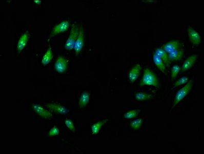 Immunofluorescence staining of Hela cells with RIPK3 Antibody at 1:266, counter-stained with DAPI. The cells were fixed in 4% formaldehyde, permeabilized using 0.2% Triton X-100 and blocked in 10% normal Goat Serum. The cells were then incubated with the antibody overnight at 4°C. The secondary antibody was Alexa Fluor 488-congugated AffiniPure Goat Anti-Rabbit IgG(H+L).Rabbit anti-Human RIPK3 Polyclonal Antibody