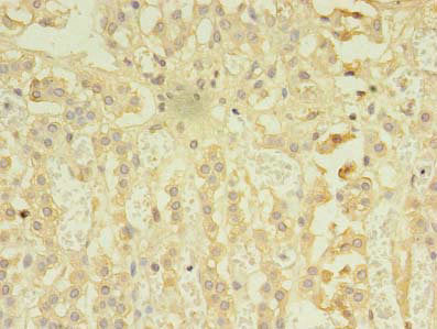 Immunohistochemistry of paraffin-embedded human adrenal gland tissue using the antibody at dilution of 1:100Rabbit anti-Human RIPK3 Polyclonal Antibody