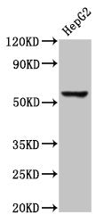 Western Blot | Positive WB detected in: HepG2 whole cell lysate | All lanes: RIPK3 antibody at 3μg/ml | Secondary | Goat polyclonal to rabbit IgG at 1/50000 dilution | Predicted band size: 57, 28, 26 kDa | Observed band size: 57 kDaRabbit anti-Human RIPK3 Polyclonal Antibody