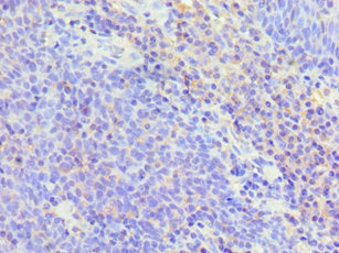 Immunohistochemistry of paraffin-embedded human tonsil tissue using TNFSF13B Antibody at dilution of 1:100Rabbit anti-Human TNFSF13B Polyclonal Antibody