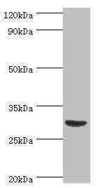 Western blot | All lanes: Tumor necrosis factor ligand superfamily member 13B antibody at 2μg/ml + Mouse liver tissue | Secondary | Goat polyclonal to rabbit IgG at 1/10000 dilution | Predicted band size: 32, 30, 18 kDa | Observed band size: 32 kDaRabbit anti-Human TNFSF13B Polyclonal Antibody