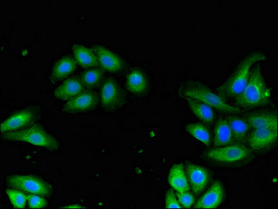 Immunofluorescent analysis of HepG2 cells using DRG1 Antibody at dilution of 1:100 and Alexa Fluor 488-congugated AffiniPure Goat Anti-Rabbit IgG(H+L)Rabbit anti-Human DRG1 Polyclonal Antibody