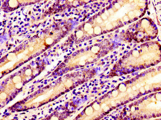 IHC image of SSX2IP Antibody diluted at 1:100 and staining in paraffin-embedded human small intestine tissue performed on a Leica BondTM system. After dewaxing and hydration, antigen retrieval was mediated by high pressure in a citrate buffer (pH 6.0). Section was blocked with 10% normal goat serum 30min at RT. Then primary antibody (1% BSA) was incubated at 4°C overnight. The primary is detected by a biotinylated secondary antibody and visualized using an HRP conjugated SP system.
