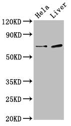 Western Blot  | Positive WB detected in: Hela whole cell lysate, Rat liver tissue  | All lanes: SSX2IP antibody at 3µg/ml  | Secondary  | Goat polyclonal to rabbit IgG at 1/50000 dilution  | Predicted band size: 72, 66, 69 kDa  | Observed band size: 72 kDa