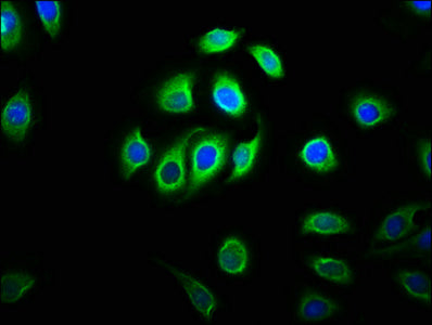 Immunofluorescence staining of A549 cells with MYRF Antibody at 1:133, counter-stained with DAPI. The cells were fixed in 4% formaldehyde, permeabilized using 0.2% Triton X-100 and blocked in 10% normal Goat Serum. The cells were then incubated with the antibody overnight at 4°C. The secondary antibody was Alexa Fluor 488-congugated AffiniPure Goat Anti-Rabbit IgG(H+L).Rabbit anti-Human MYRF Polyclonal Antibody