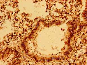 Immunohistochemistry of paraffin-embedded human lung tissue using MYRF Antibody at dilution of 1:100Rabbit anti-Human MYRF Polyclonal Antibody