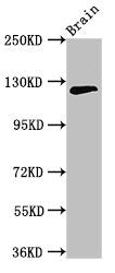 Western Blot | Positive WB detected in: Mouse brain tissue | All lanes: MYRF antibody at 3.2μg/ml | Secondary | Goat polyclonal to rabbit IgG at 1/50000 dilution | Predicted band size: 125, 121 kDa | Observed band size: 125 kDaRabbit anti-Human MYRF Polyclonal Antibody