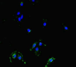 Immunofluorescent analysis of Hela cells using MAST1 Antibody at dilution of 1:100 and Alexa Fluor 488-congugated AffiniPure Goat Anti-Rabbit IgG(H+L)