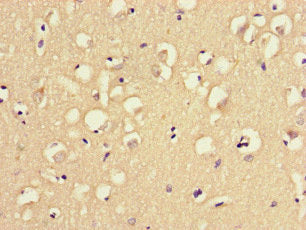Immunohistochemistry of paraffin-embedded human brain tissue using MAST1 Antibody at dilution of 1:100