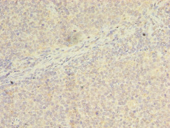 Immunohistochemistry of paraffin-embedded human tonsil tissue using WDR37 Antibody at dilution of 1:100Rabbit anti-Human WDR37 Polyclonal Antibody