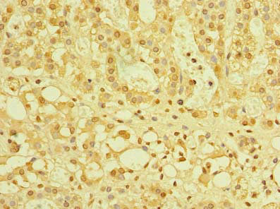 Immunohistochemistry of paraffin-embedded human adrenal gland tissue using ZBTB32 Antibody at dilution of 1:100Rabbit anti-Human ZBTB32 Polyclonal Antibody