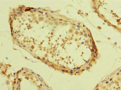Immunohistochemistry of paraffin-embedded human testis tissue using ZBTB32 Antibody at dilution of 1:100Rabbit anti-Human ZBTB32 Polyclonal Antibody