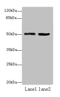 Western blot | All lanes: ZBTB32 antibody at 4μg/ml | Lane 1: Mouse brain tissue | Lane 2: Jurkat whole cell lysate | Secondary | Goat polyclonal to rabbit IgG at 1/10000 dilution | Predicted band size: 53 kDa | Observed band size: 53 kDaRabbit anti-Human ZBTB32 Polyclonal Antibody