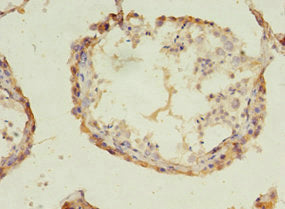 Immunohistochemistry of paraffin-embedded human testis tissue using the antibody at dilution of 1:100