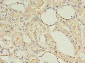 Immunohistochemistry of paraffin-embedded human kidney tissue using ACOT9 Antibody at dilution of 1:100