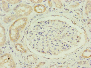 Immunohistochemistry of paraffin-embedded human kidney tissue using FAM96B Antibody at dilution of 1:100Rabbit anti-Human FAM96B Polyclonal Antibody