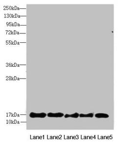 Western blot  | All lanes: FAM96B antibody at 7.23µg/ml  | Lane 1: Mouse gonadal tissue  | Lane 2: MCF-7 whole cell lysate  | Lane 3: Hela whole cell lysate  | Lane 4: K562 whole cell lysate  | Lane 5: A375 whole cell lysate  | Secondary  | Goat polyclonal to rabbit IgG at 1/10000 dilution  | Predicted band size: 18 kDa  | Observed band size: 18 kDaRabbit anti-Human FAM96B Polyclonal Antibody