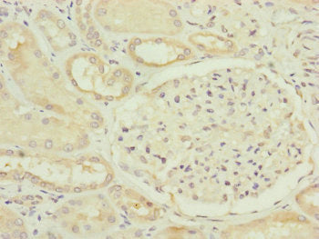 Immunohistochemistry of paraffin-embedded human kidney tissue using FAM96B Antibody at dilution of 1:100Rabbit anti-Human FAM96B Polyclonal Antibody