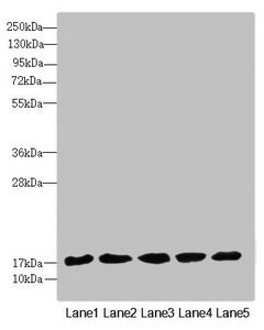 Western blot  | All lanes: FAM96B antibody at 7.09µg/ml  | Lane 1: Mouse gonadal tissue  | Lane 2: MCF-7 whole cell lysate  | Lane 3: Hela whole cell lysate  | Lane 4: K562 whole cell lysate  | Lane 5: A375 whole cell lysate  | Secondary  | Goat polyclonal to rabbit IgG at 1/10000 dilution  | Predicted band size: 18 kDa  | Observed band size: 18 kDaRabbit anti-Human FAM96B Polyclonal Antibody