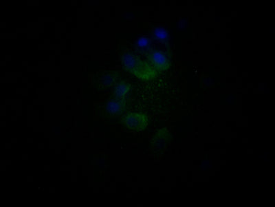 Immunofluorescence staining of HepG2 cells with TRIM17 Antibody at 1:25, counter-stained with DAPI. The cells were fixed in 4% formaldehyde, permeabilized using 0.2% Triton X-100 and blocked in 10% normal Goat Serum. The cells were then incubated with the antibody overnight at 4°C. The secondary antibody was Alexa Fluor 488-congugated AffiniPure Goat Anti-Rabbit IgG(H+L).Rabbit anti-Human TRIM17 Polyclonal Antibody