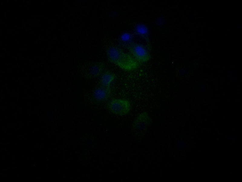 Immunofluorescence staining of HepG2 cells with TRIM17 Antibody at 1:25, counter-stained with DAPI. The cells were fixed in 4% formaldehyde, permeabilized using 0.2% Triton X-100 and blocked in 10% normal Goat Serum. The cells were then incubated with the antibody overnight at 4°C. The secondary antibody was Alexa Fluor 488-congugated AffiniPure Goat Anti-Rabbit IgG(H+L).Rabbit anti-Human TRIM17 Polyclonal Antibody