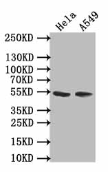 Western BlotPositive WB detected in: Hela whole cell lysate,A549 whole cell lysateAll lanes: TRIM17 antibody at 1:500SecondaryGoat polyclonal to rabbit IgG at 1/50000 dilutionPredicted band size: 55,40 kDaObserved band size: 55 kDaRabbit anti-Human TRIM17 Polyclonal Antibody