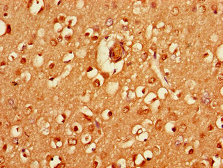 Immunohistochemistry of paraffin-embedded human brain tissue using HRH3 Antibody at dilution of 1:100Rabbit anti-Human HRH3 Polyclonal Antibody